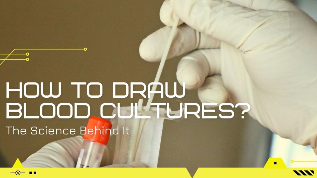 How to draw blood cultures? The Science Behind It Germany Daily